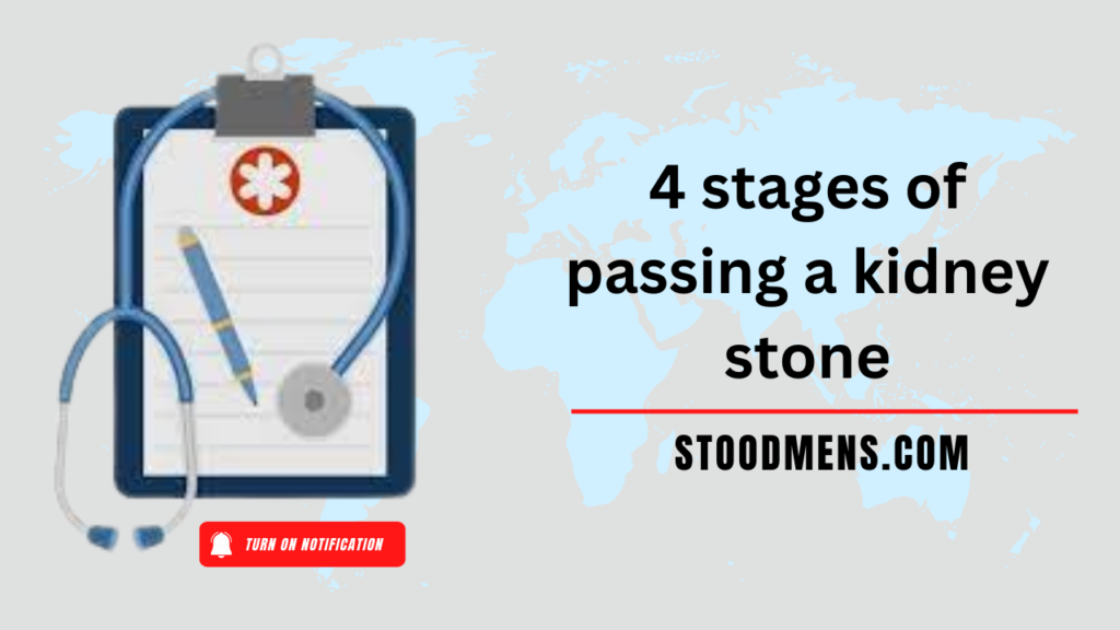 4 stages of passing a kidney stone