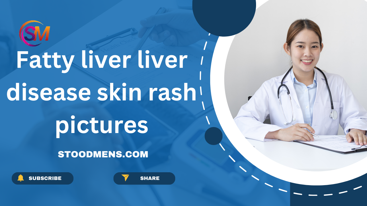fatty liver liver disease skin rash pictures