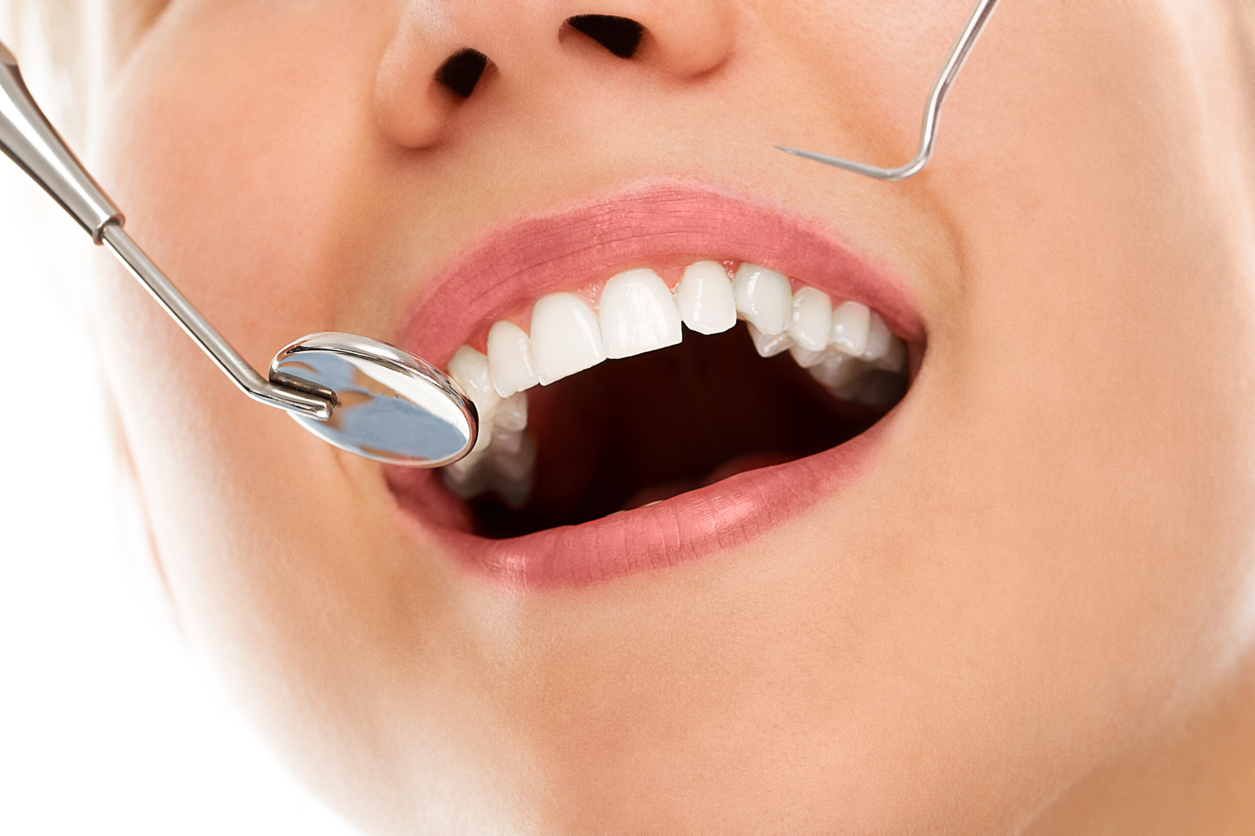 Quick pain relief strategies after teeth cleaning