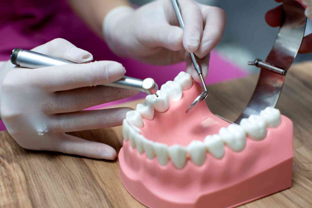 Dental Implants on Front Teeth