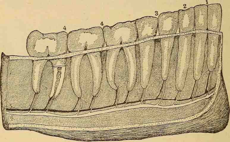 When Can I Eat Solid Food After Wisdom Teeth Removal?