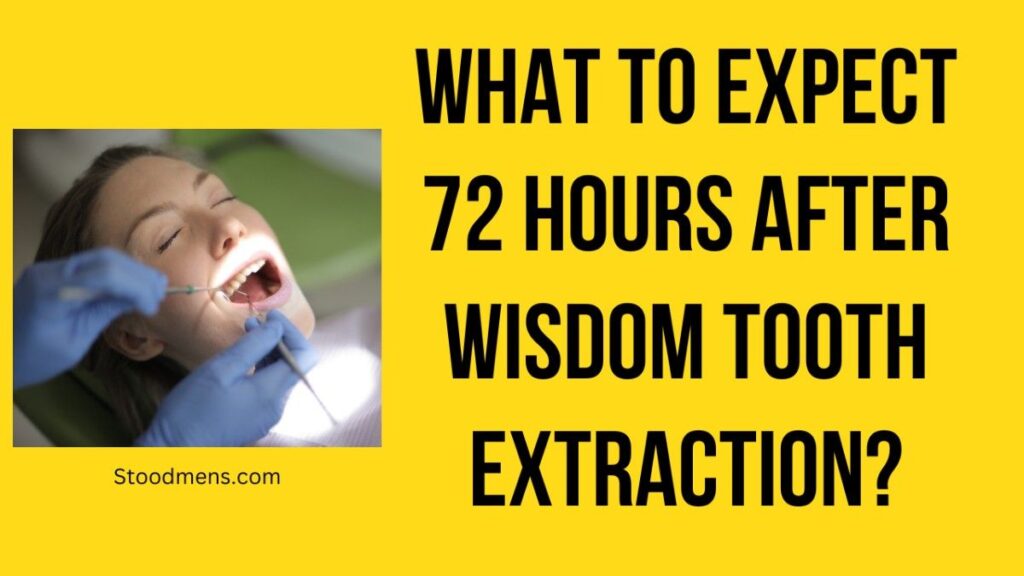 What to Expect 72 Hours After Wisdom Tooth Extraction?