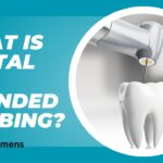 How Long Does Dental Numbing Last
