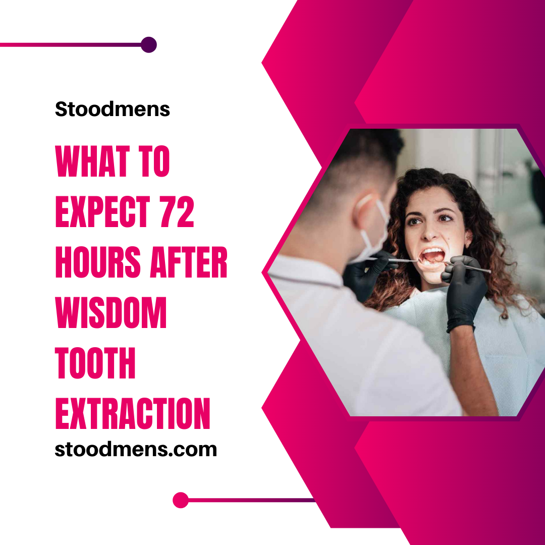 What to expect 72 hours after wisdom tooth extraction