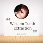 Wisdom Tooth Extraction