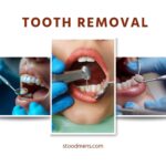 Wisdom Tooth Removal