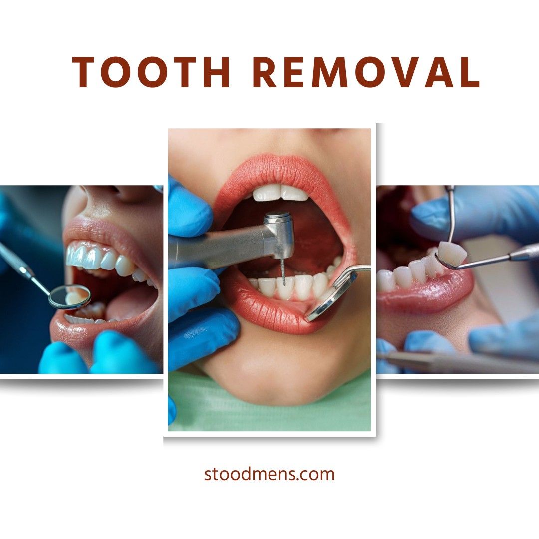 Wisdom Tooth Removal