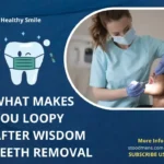 What makes you loopy after wisdom teeth removal